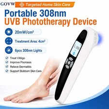 308nm Excimer UVB Light Therapy Phototherapy 20mW/cm2 Skin Care for Home Use