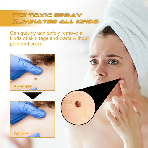 Tag Recede Bee Venom Treatment Spray,Tag Recede,Bee Venom Spray for All Skin New - Picture 5 of 13