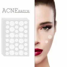 180 Pimple Patches Dots Hydrocolloid Acne Spot Stickers Cystic Acne Patch Heal