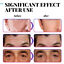 thumbnail 11  - Men&#039;s Face Anti Wrinkle Skin Cream Collagen Retinol Hyaluronic Acid Vitamin E