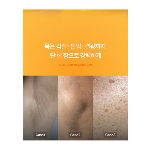 Medicube Kojic Acid Turmeric Pad 70pcs K-Beauty - Picture 3 of 4