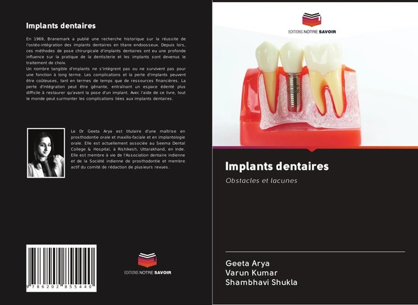 Geeta Arya (U. A.) | Implants Dentaires | Taschenbuch | FranzöSisch (2020)-image