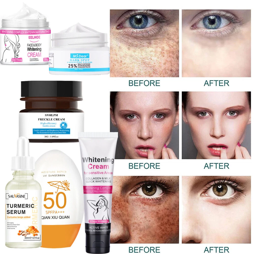 Best fairness cream sale for dark skin