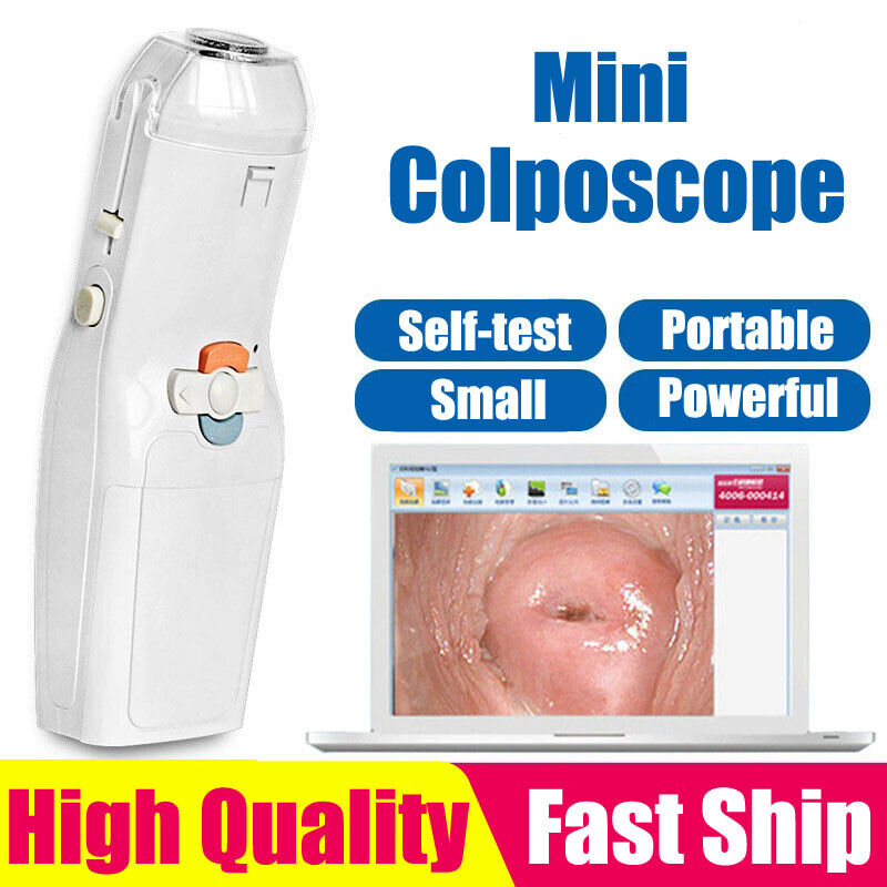 Portable Digital Electronic Video Mini Pi Colposcope Branded goods 3000000 safety FA2