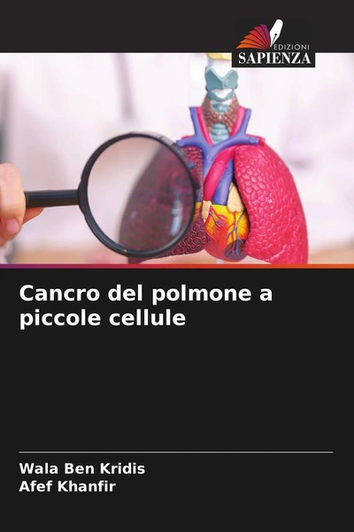 Wala Ben Kridis (U. A.) | Cancro Del Polmone A Piccole Cellule | Taschenbuch-image