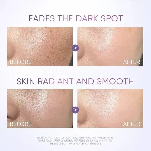 SKINTIFIC SymWhite 377 Dark Spot Serum Brightening Serum 20ml ( X 2 ) - Afbeelding 4 van 10