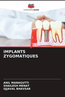 Anil Managutti (U. A.) | Implants Zygomatiques | Taschenbuch | FranzöSisch