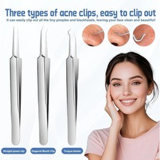 Acne Needle Blackhead Remover Pimple Blemish Comedone Extractor Tweezer Tool Kit