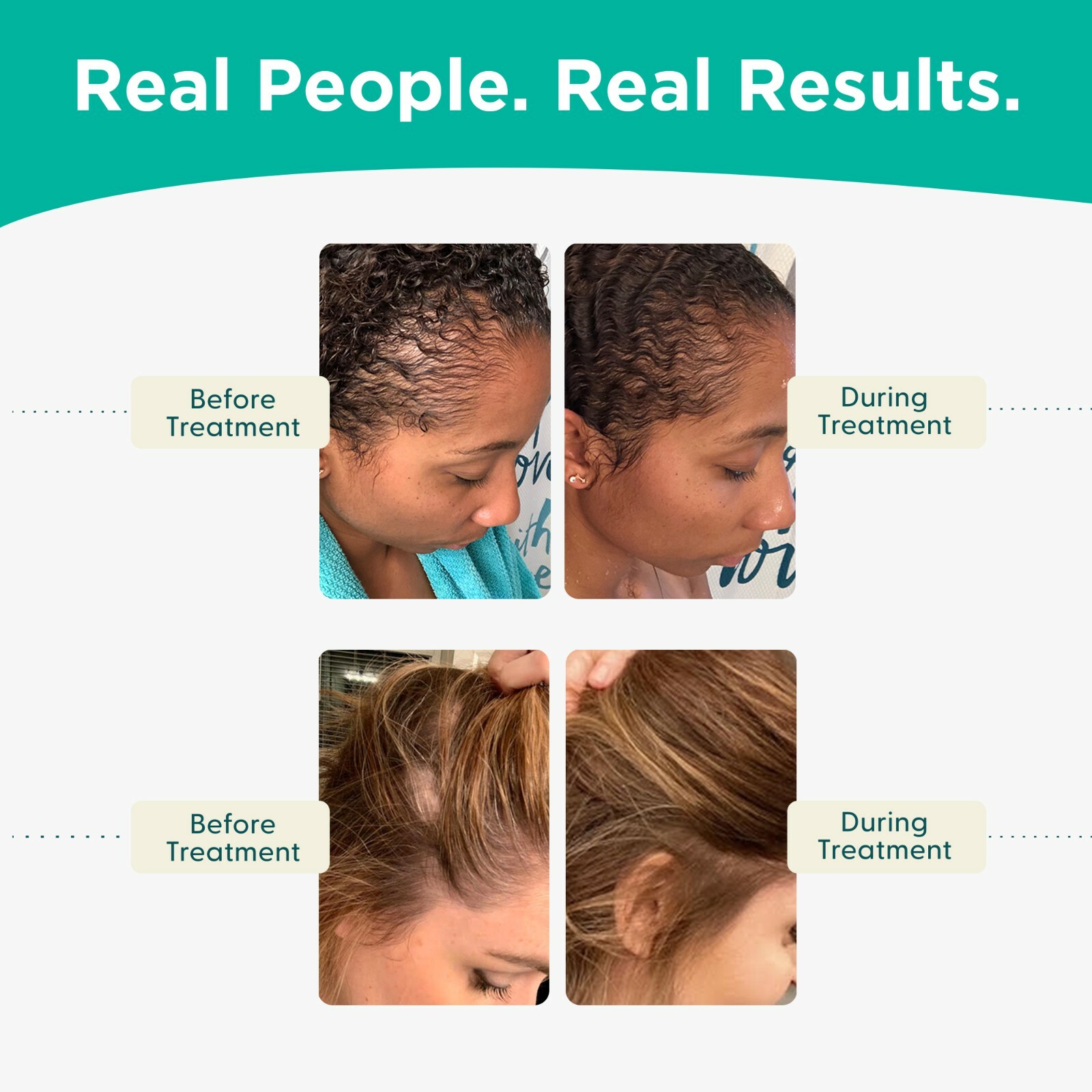 Shapiro MD Hair Loss Vegan Thickening Shampoo, Hair Loss Treatment Men and Women