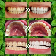 Teeth Restoration Mineral Powder, Mineral Tooth Powder, Tooth Restoration