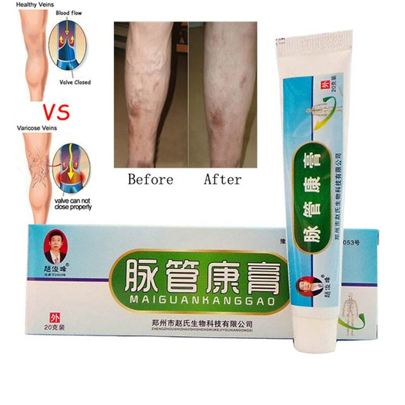 Tratamiento De Varices Vascular 10 Piezas Natural Chino Medicina De Hierbas Crema