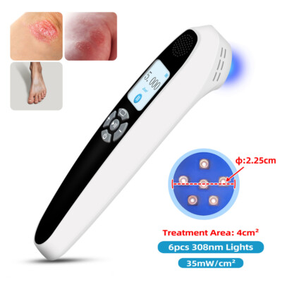 308nm Excimer System Uv Light Treatment for Skin Diseases Device 0-5J Adjustable