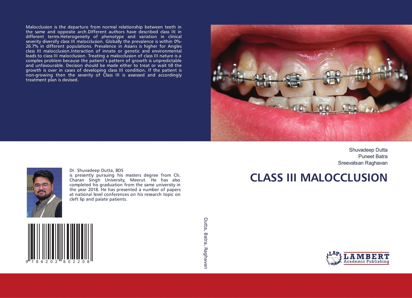 Thumbnail - Class Iii Malocclusion | Shuvadeep Dutta (u. A.) | Taschenbuch |