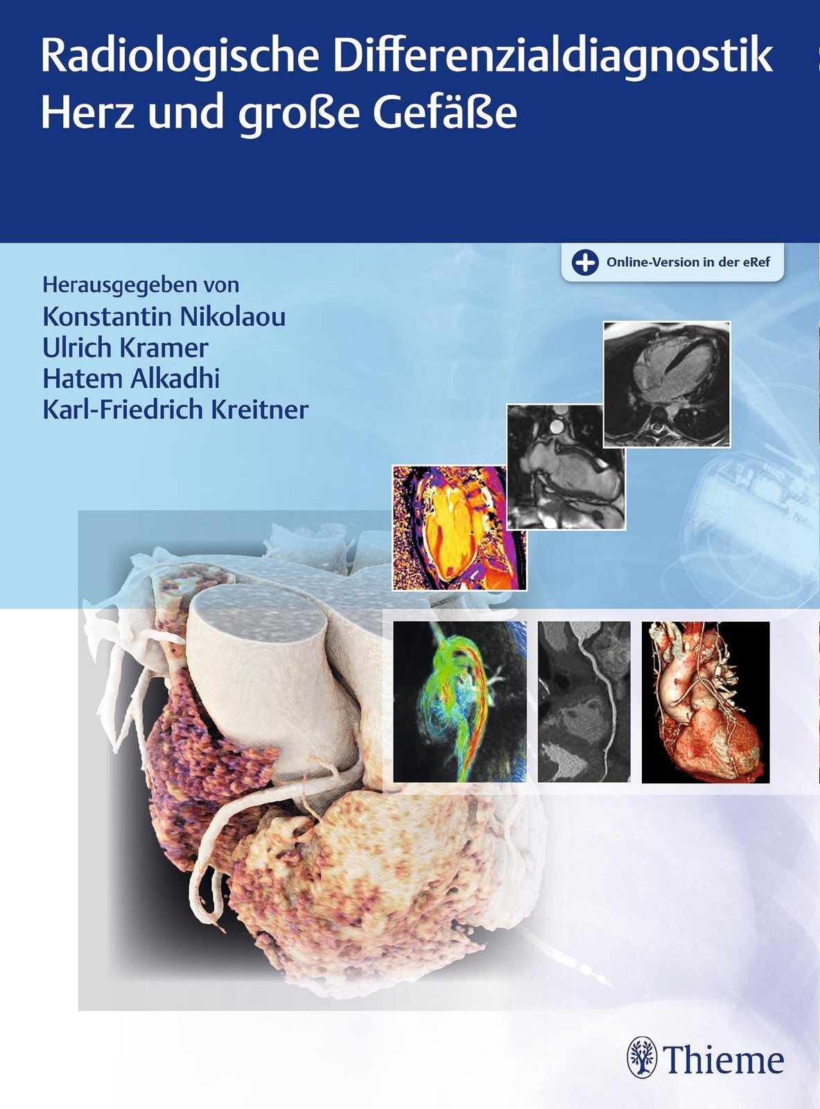 Thumbnail - Radiologische Differenzialdiagnostik Herz Und Große Gefäße, Konstantin