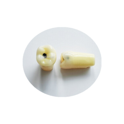10Pcs Dental Molar Vitro Teeth Decay Caries Tooth Model Dentist Student School