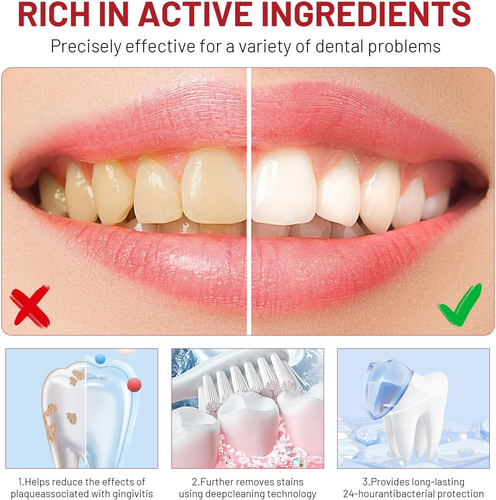 3PCS SIP-4 Probiotic Whitening Toothpaste Removes Bad Breath Dental Plate Stain - Picture 3 of 7