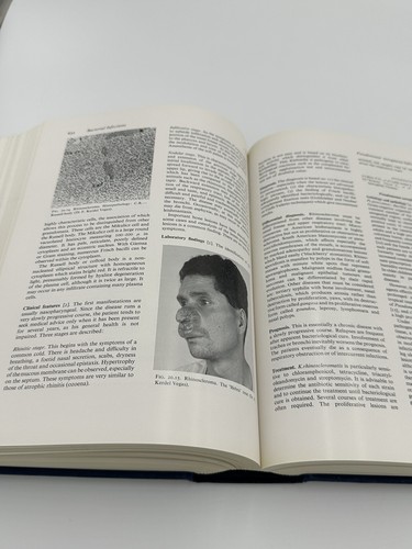 TEXTBOOK OF DERMATOLOGY By Arthur D. S. Wilkinson And F. J. G. Ebling Rook 1 & 2 - Picture 9 of 16