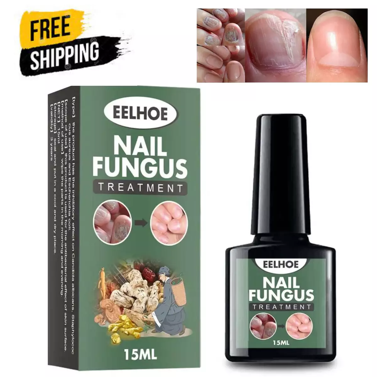 Best fungal sale nail treatment uk