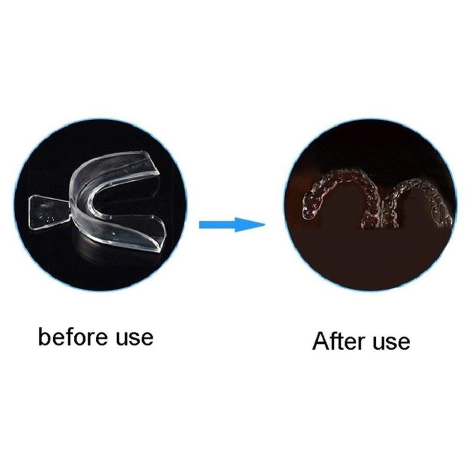 Orthodontic Retainer Fixed Corrector Teeth Retainers Thermoforming 2 ...