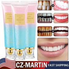 Body Accel -Niacinamide Whitening Toothpaste ...