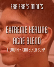 Fra Fra's Mini's  Premium EXTREME Liquid Black Soap Healing Acne Blend - 4 oz
