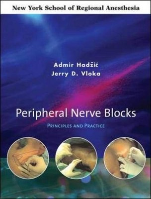 Peripheral Nerve Blocks: Principles and Practice by Vloka, Jerry Hardback Book
