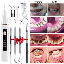 Ultrasonic Electric Tooth Cleaner Tartar Plaque Remover Dental Scaler Tool Kit