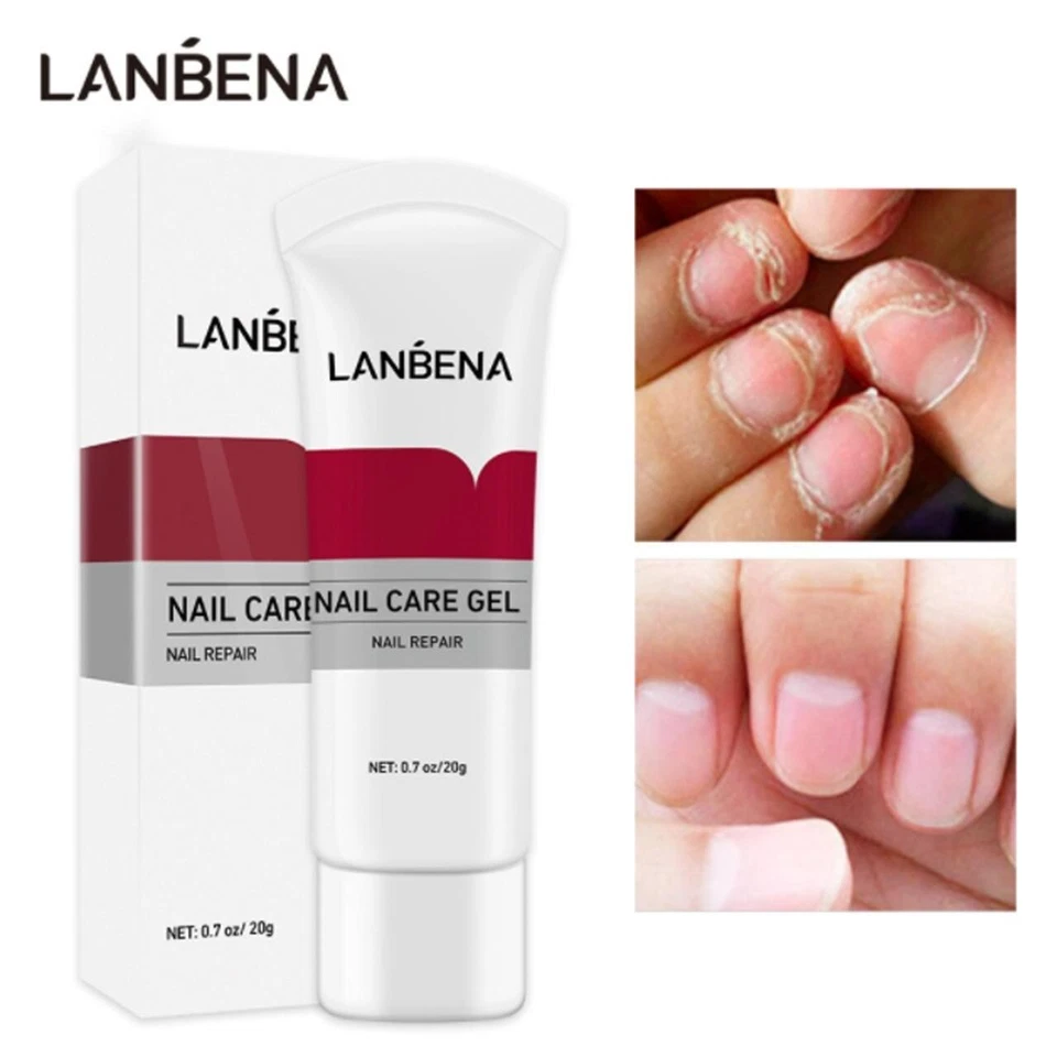 LANBENA Nail Repair Serum Fungal Nail Treatment Liquid Remove Onychomycosis Toe Essence