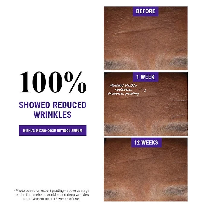 KIEHL’S RETINOL SUERO MICRODOSIS DIARIO CON CERAMIDAS Y PÉPTIDO (1 OZ/30 ML) NUEVO Foto 3 de 4