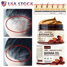 Natural Batana Oil Conditioner For Hair Growth Healthier Fuller Anti Hair Loss