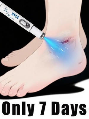 Blue light pen solve scar, best-selling product