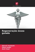 Shivali Vashisht (U. A.) | RegeneraçãO óSsea Guiada | Taschenbuch (2023)