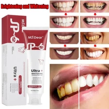 Sp-6 Probiotic Brightening Toothpaste Teeth Whitening Fresh Breath Remove Breath