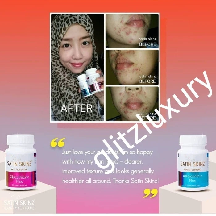 Satin Skinz Duo pack gluta tabs skin whitening supplement. 2 in a box👌👌 - Image 2 of 4