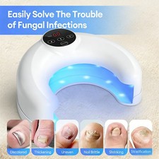 New 45W Nail Fungus Treatment Wireless Ingrown Toenail Treatment Device
