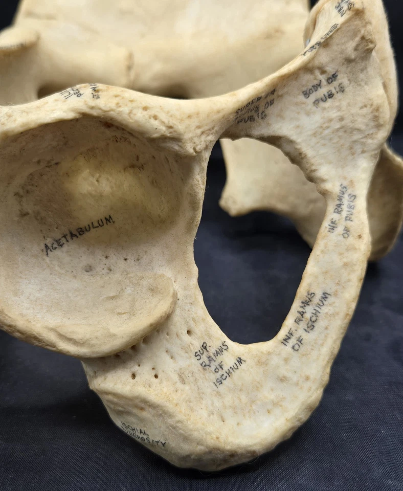 Pelvis adulta hembra con demostrador de paciente L4 y L5 de Sawbones completamente etiquetado Foto 4 de 4