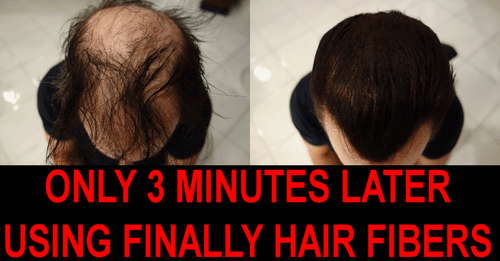 Keratin Style Hair Building Fibers Refill 25g FINALLY HAIR Loss Concealer Filler - Picture 4 of 11