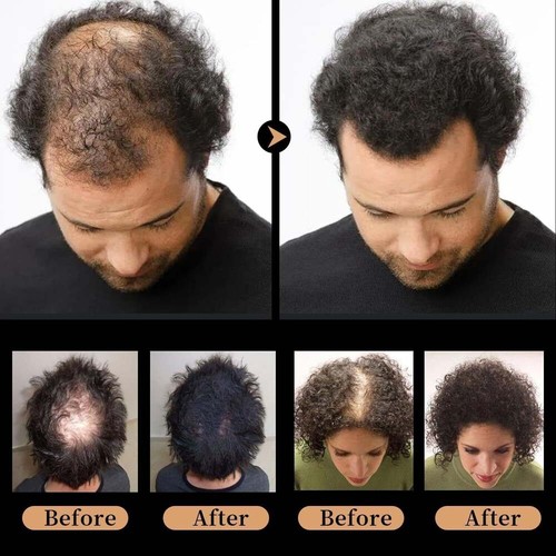 New Spartan Root Activator Shampoo: Natural Hair Regrowth & Hair Loss Solution - Picture 3 of 13