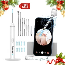 WiFi Otoscope with 6 LED Light,Electric Ear Wax Removal Kit,1920P HD Ear Cleaner