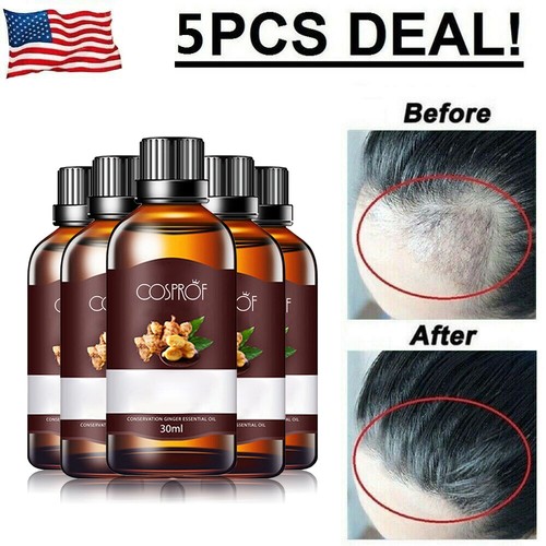 HyunGang Korea Ginger Hair Growth Serum - 30ml Anti-Hair Loss Treatment With Natural Ginger Extract - Dense Regrowth Oil 8 thumbnail image