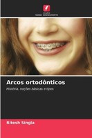 Arcos OrtodôNticos Ritesh Singla