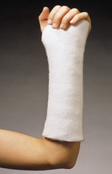 Left Hand Volar Splint