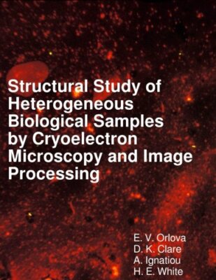 Structural Study of Heterogeneous Biological Samples by Cryoelectron Microsco-,