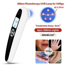 308nm UVB Ultraviolet Phototherapy Lamp Instrument for Hand Leg Skin Treatment