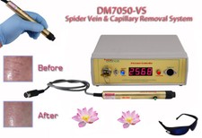 Brand New laser removal of spider and vericose veins for legs, face, nose.