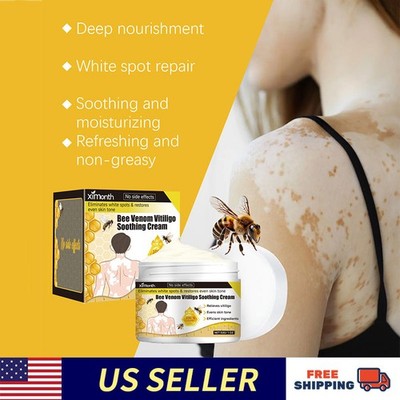 1-5 pack VitiClear Pro Bee Venom Cream, Organic Formula, 30g (1).
