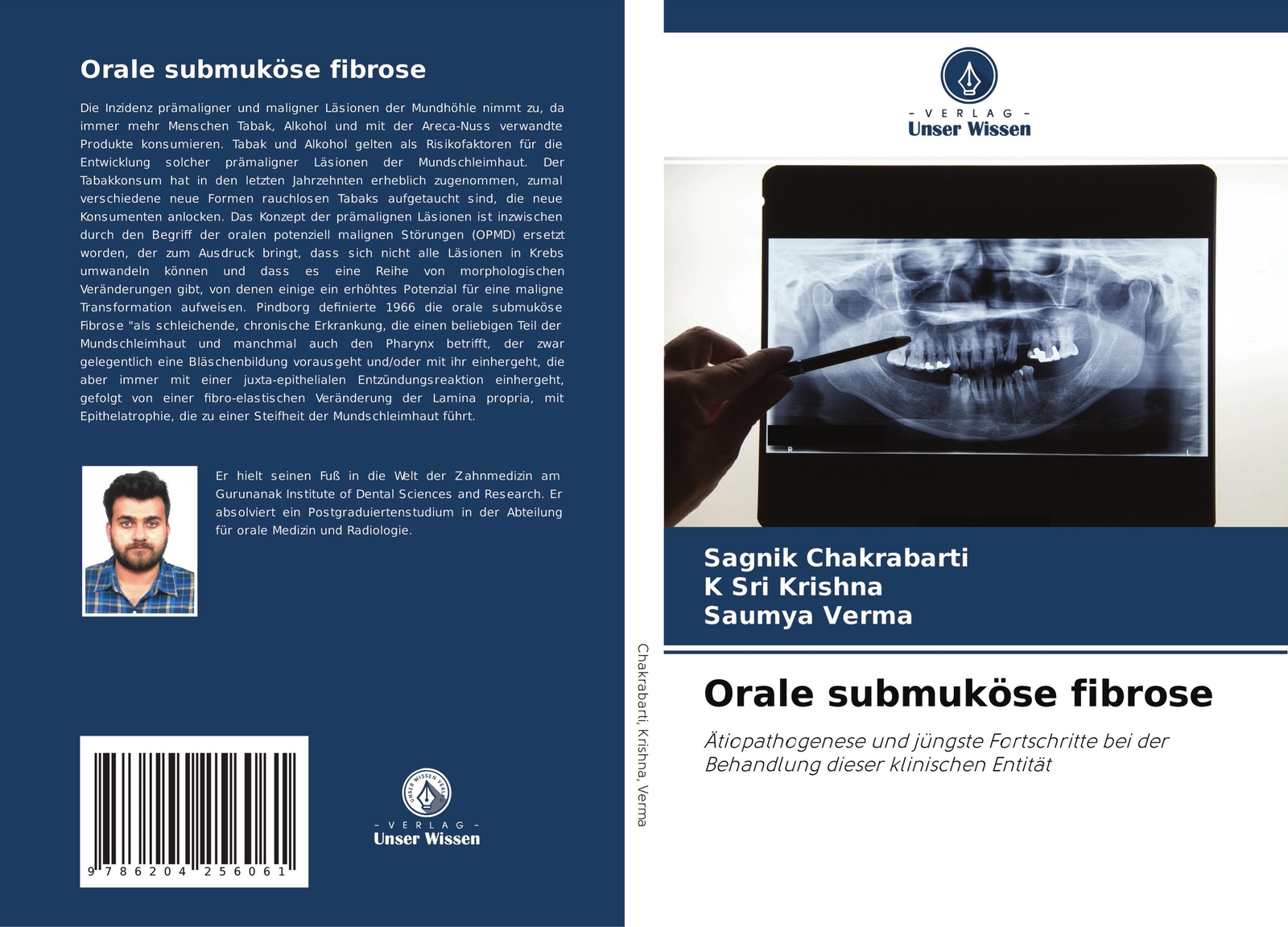 Thumbnail - Sagnik Chakrabarti (u. A.) | Orale Submuköse Fibrose | Taschenbuch |