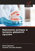 Gauri Agrawal (U. A.) | Najnowsze Post¿Py W Leczeniu G¿¿Bokich ZgryzóW | Buch