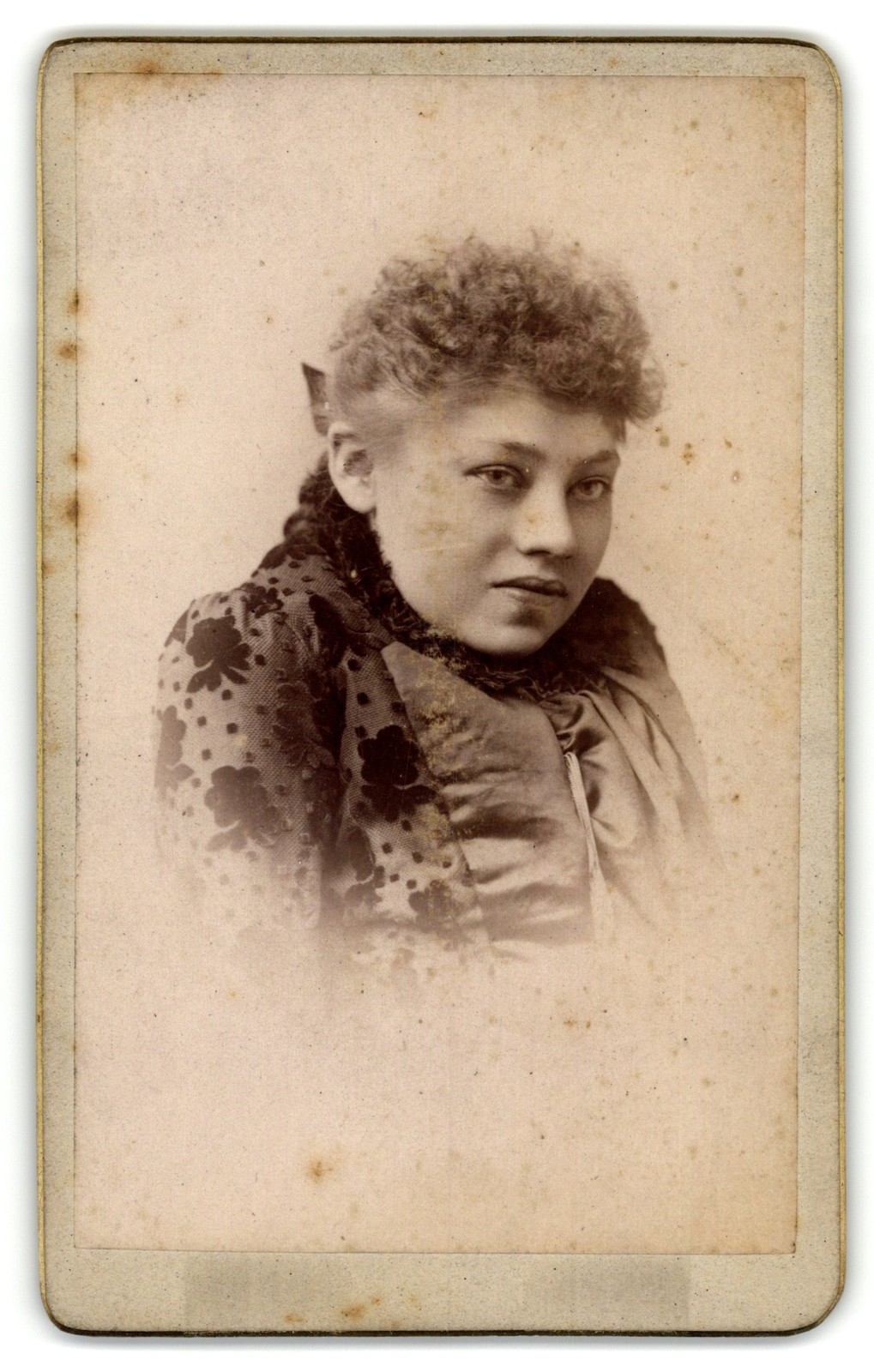 Antique CDV C. 1890s Young Gorgeous Lady Curly Hair Bow Floral Dress Hunchback