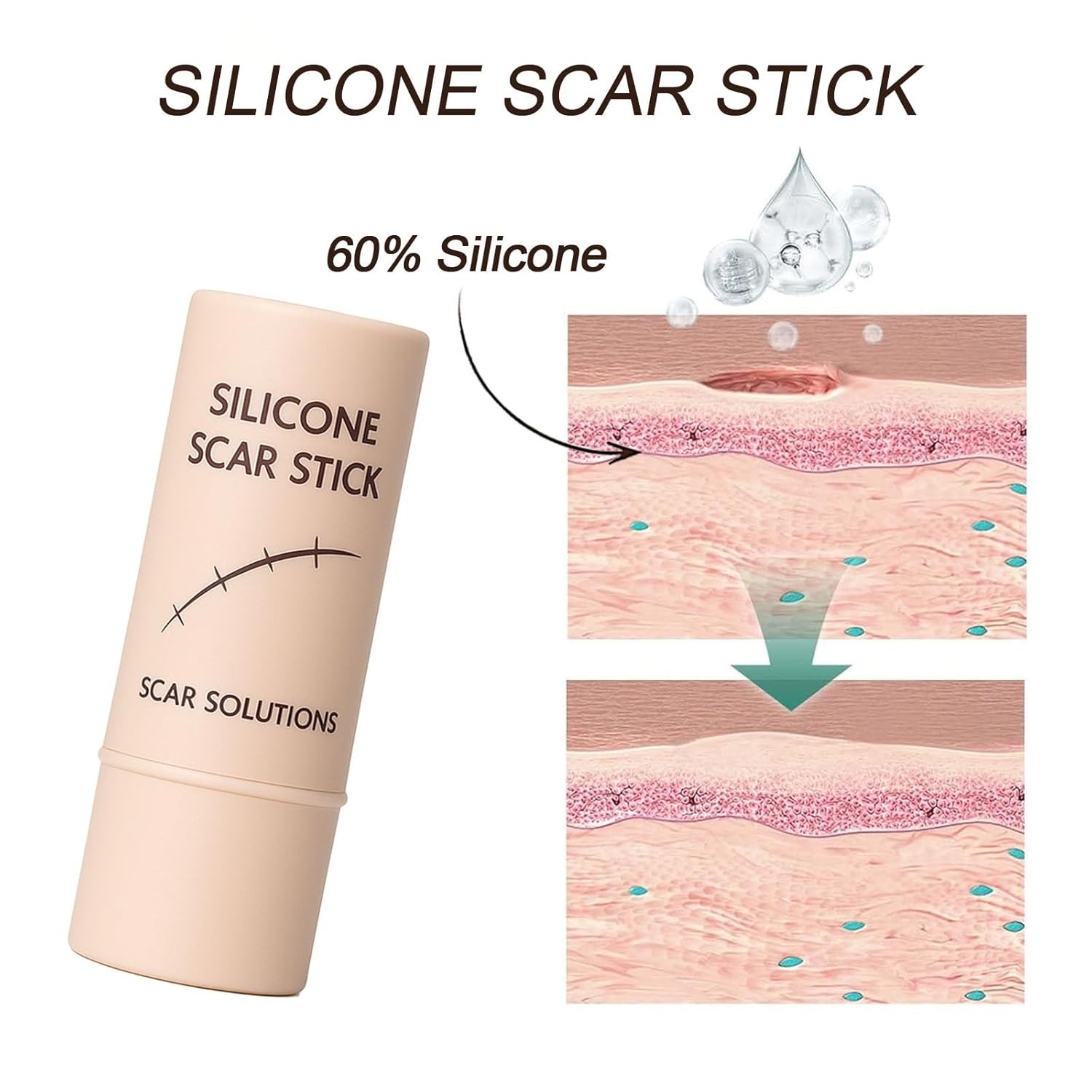 Silicone Scar Stick,containing 60% silicone scar repair ingredients,fades scars.